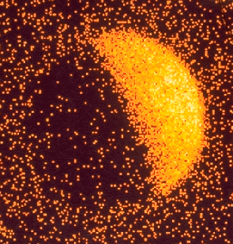X-Raying the Moon