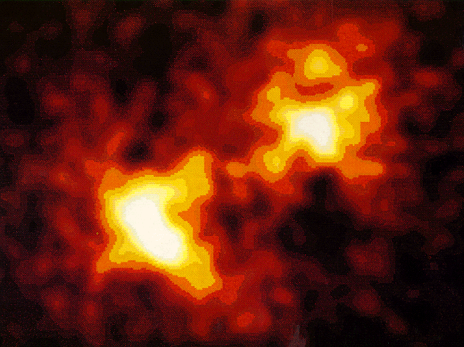 An X-ray Hot Supernova in M81