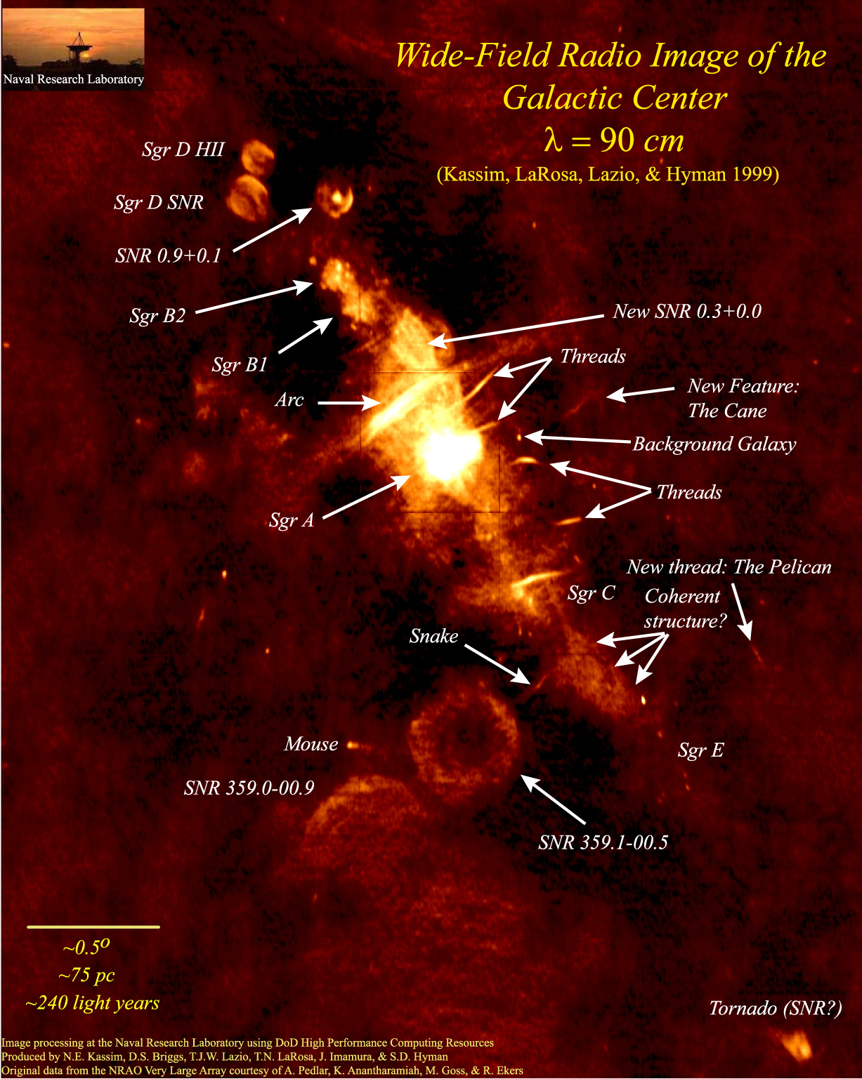 The Galactic Center - A Radio Mystery
