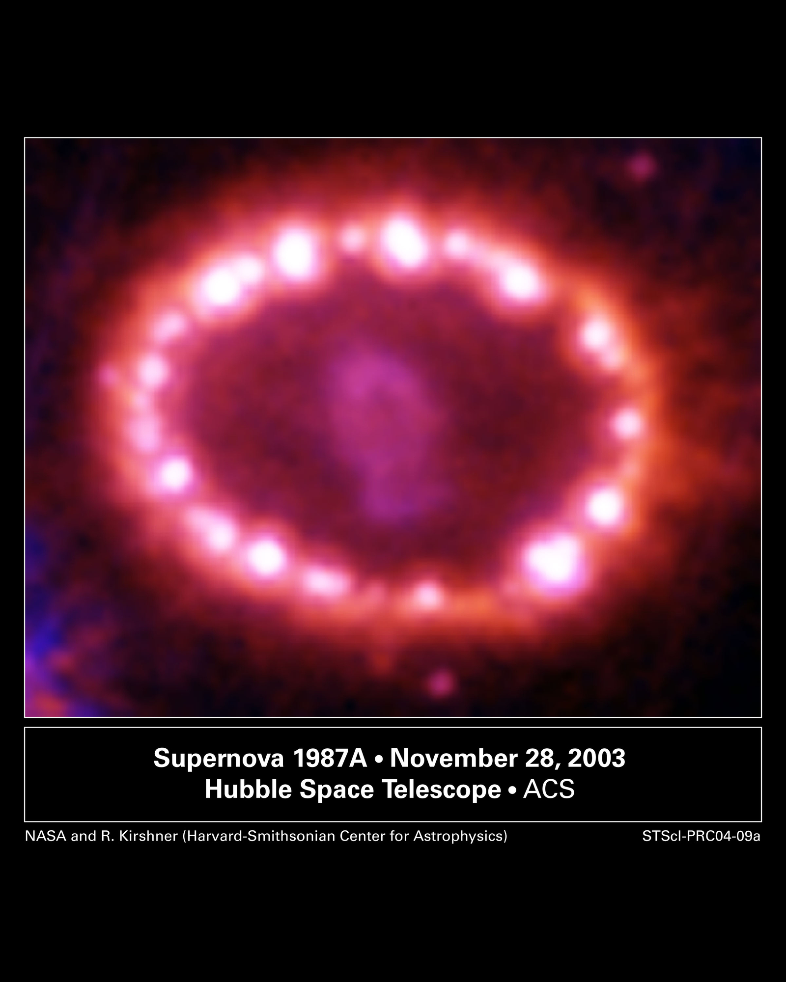 SN1987A's Cosmic Pearls