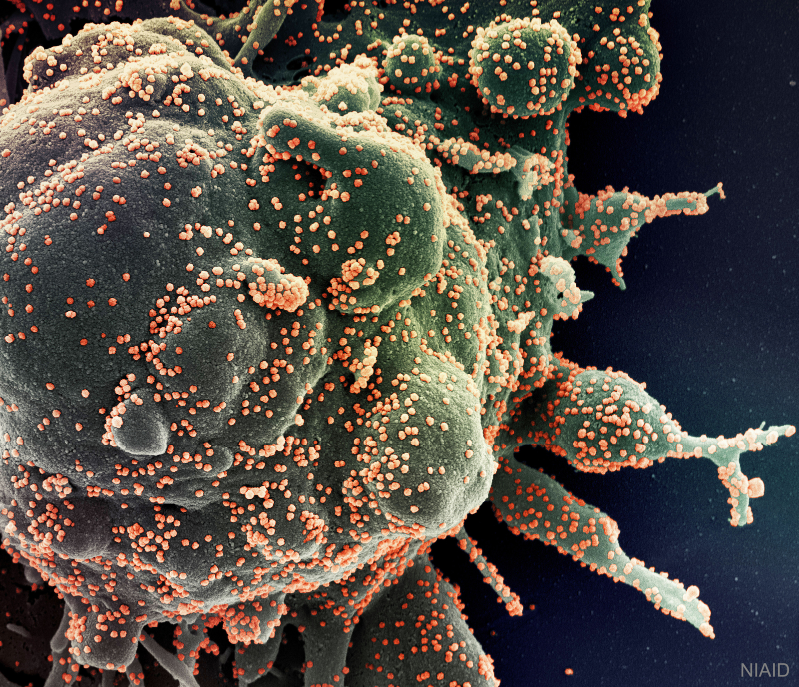 Novel Coronavirus Attacks Humanity