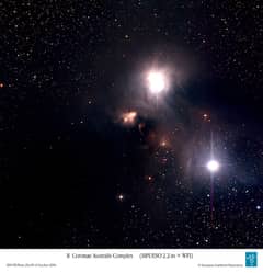 Preview of Dust and Gas Surrounding Star R Coronae Australis