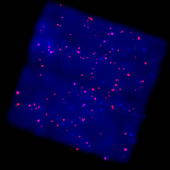Preview of X-Rays from the Galactic Plane