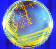 Preview of D. rad Bacteria: Candidate Astronauts