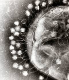 Preview of Bacteriophages: The Most Common Life-Like Form on Earth
