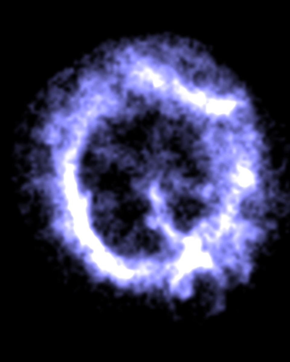 X-ray Hot Supernova Remnant in the SMC