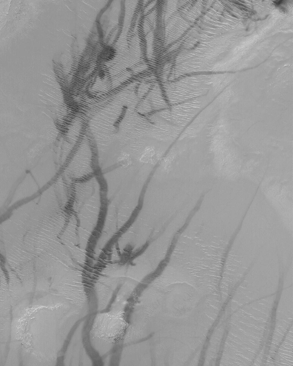 Martian Dust Devil Trails