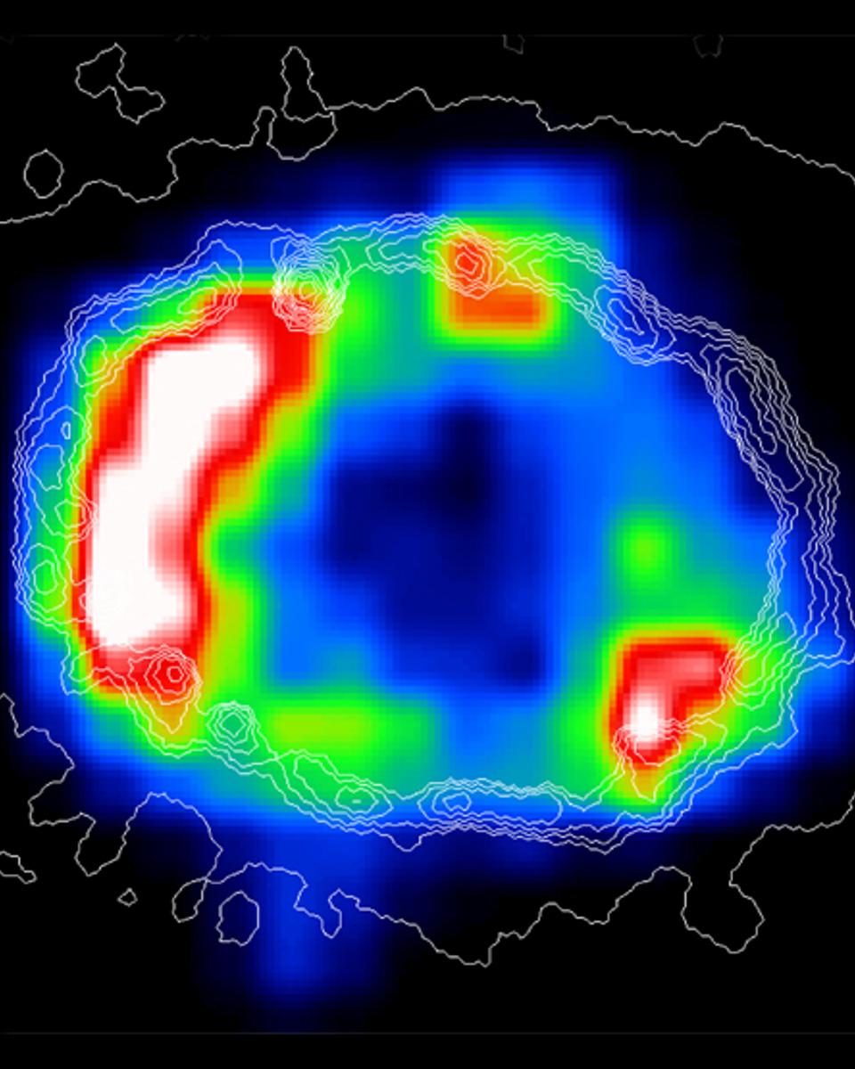 X-Ray Ring Around SN1987A