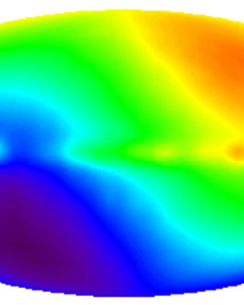 CMB Dipole: Speeding Through the Universe