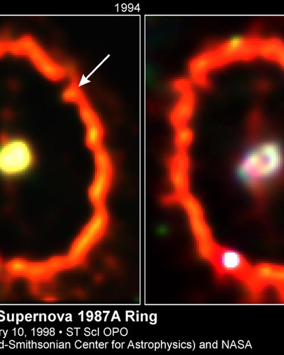 Shocked by Supernova 1987A