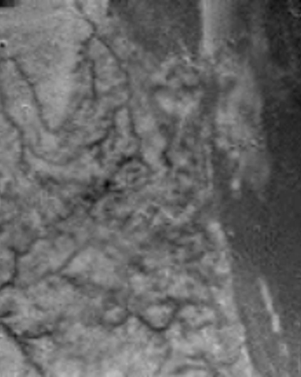 Huygens Images Titan's Surface