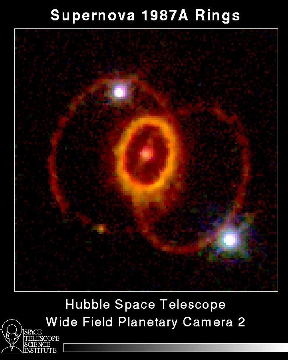 The Mysterious Rings of Supernova 1987A