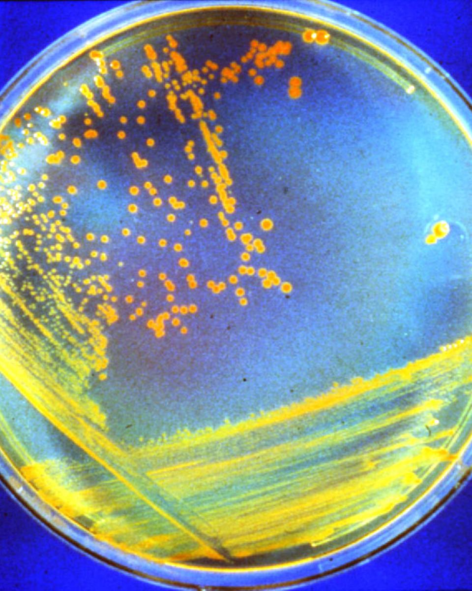 D. rad Bacteria: Candidate Astronauts
