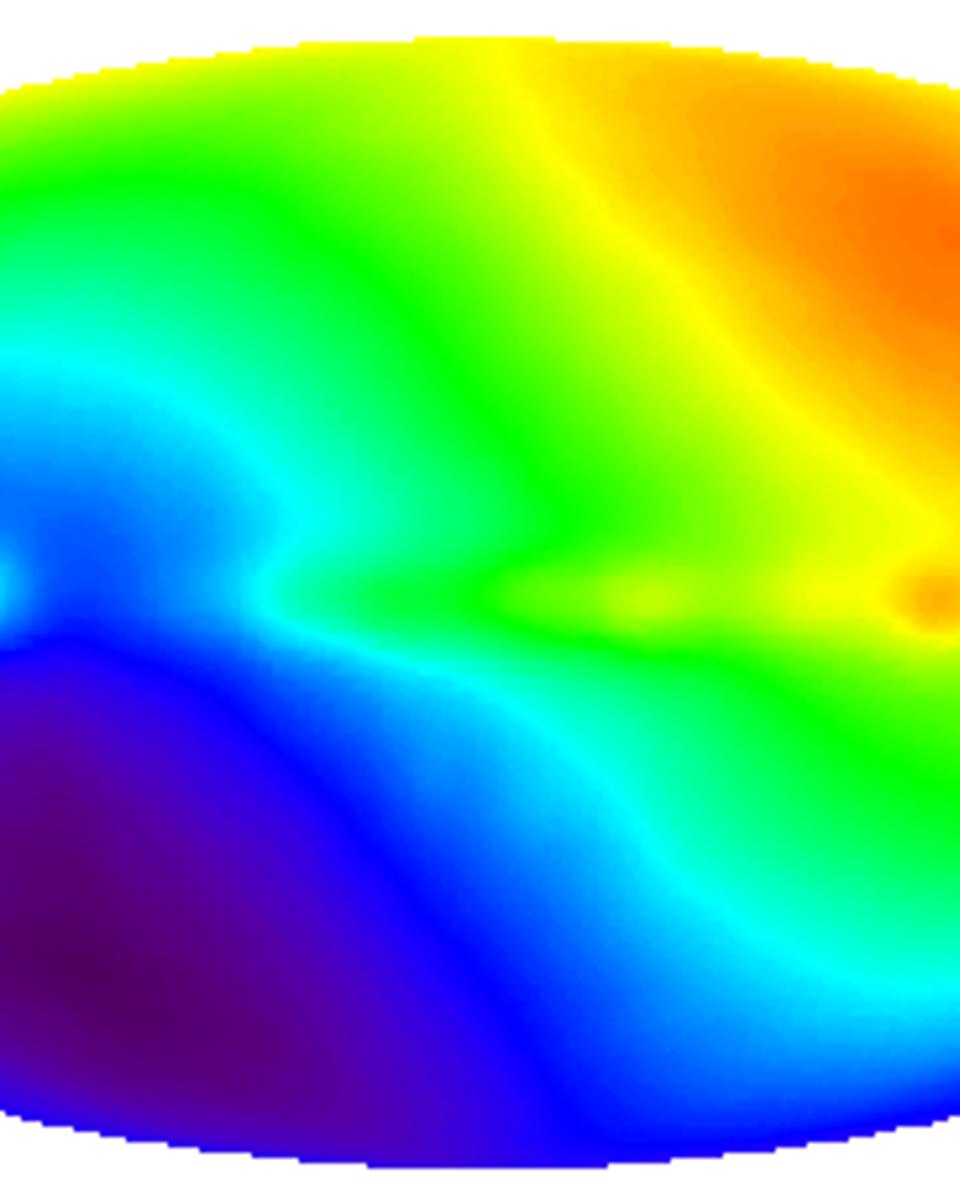 CMBR Dipole: Speeding Through the Universe