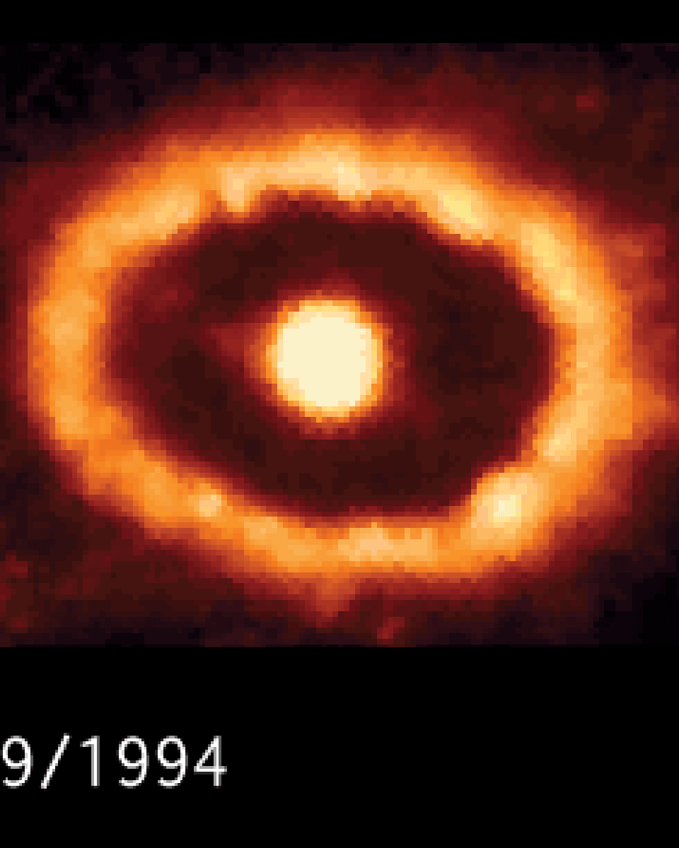 Shocked by Supernova 1987A