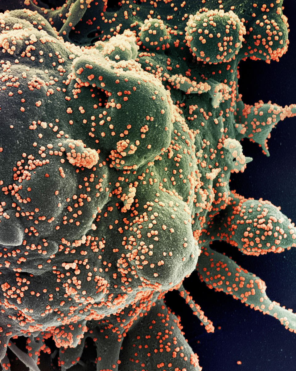 Novel Coronavirus Attacks Humanity