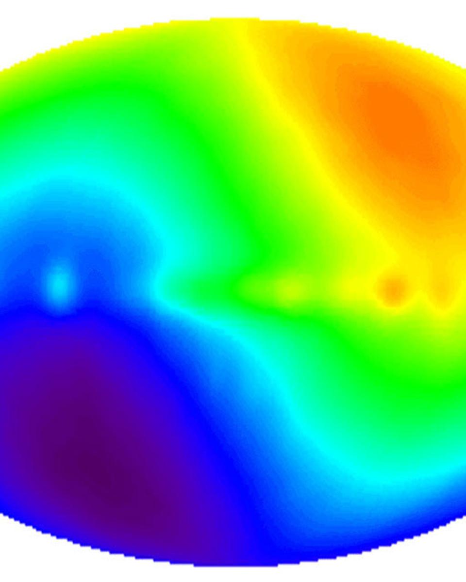 CMB Dipole: Speeding Through the Universe