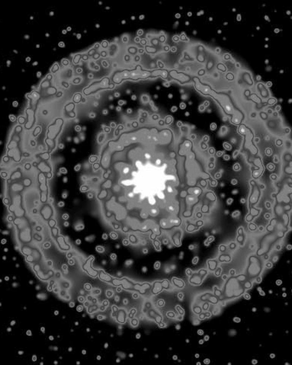 X-Ray Rings Around a Gamma Ray Burst